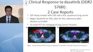 Squamous cell carcinoma Is there hope for targeted therapy [upl. by Ydnil]