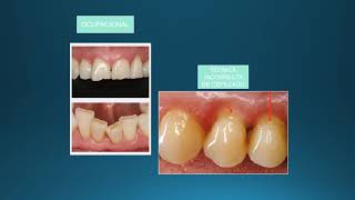 Anomalías Dentarias 2020 Parte II [upl. by Edurtreg]