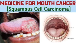 Medicine For Mouth Cancer Oral Cancer Squamous Cell Carcinoma Dr Deepak Singh [upl. by Drofyar]