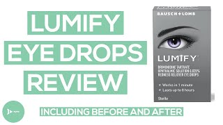 Lumify Eye Drops Review  Is Lumify Really Better Than Other Red Eye Drops [upl. by Uela545]