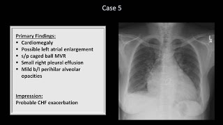 How to Interpret a Chest XRay Lesson 10  Self Assessment Part 1 [upl. by Ellemaj]