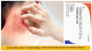 Terbicad 250mg Tablet  Terbinafine 250mg  Treat Fungal Infection फंगल इन्फेक्शन में उपयोगी [upl. by Deni]