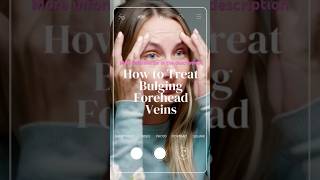 How to Treat Bulging Forehead Veins in Korea koreanbeauty seoultravel korea bulgingforehead [upl. by Nelloc]