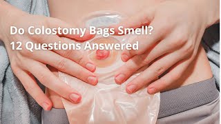 Do Colostomy Bags Smell 12 Questions Answered [upl. by Abdulla]