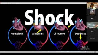 Cardiogenic shock AMC [upl. by Stein503]