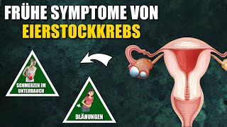 4 Frühe Symptome von Eierstockkrebs auf die du achten solltest [upl. by Ahseket]