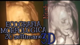 Video Ecografia MORFOLOGICA in 3D 20 settimane di gravidanza💙 Noah💙 [upl. by Halik486]