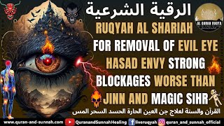 Most Powerful Ruqyah Treatment  Evil Eye Ayn And Envy Hasad [upl. by Sy]