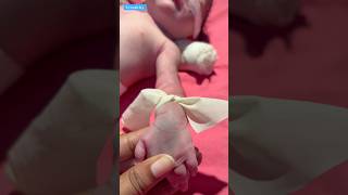 Vein Findermedical newbornbaby viralvideo [upl. by Enimzzaj]