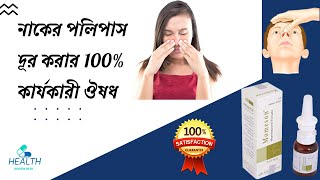 Momeson Nasal Spray  polyps treatment Bangla নাকের পলিপাস দূর করার উপায় nasal polyps symptoms [upl. by Peppard693]