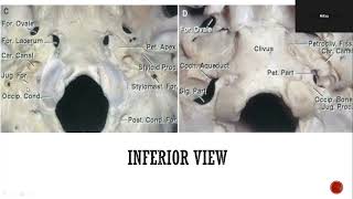 Anatomy of Jugular Foramen [upl. by Anirahtak]