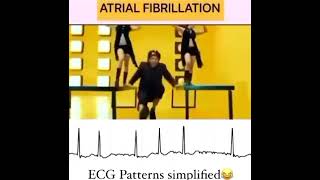 Learn ECG Reading wiithin a minute [upl. by Scheers608]