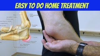 Elbow Bursitis Treatment at Home  How to Treat Olecranon Bursitis [upl. by Goren]