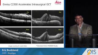 Bioptigen Driving Intrasurgical OCT Use OISASRS 2016 [upl. by Gunas]