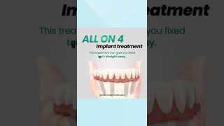 All on 4 Dental Implants in Los Algodones Mexico by All on X Dental Studio [upl. by Heall]