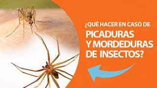 ¿Qué hacer en caso de picaduras y mordeduras de insectos [upl. by Nylime328]