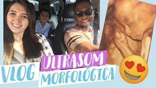 VLOG DA ULTRASOM MORFOLÓGICA 24 SEMANAS [upl. by Suiratnod917]