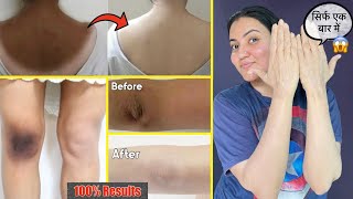 Dark Neck Elbow Knee Back Full Body Tan कालेपन को जड़ से खत्म करें सिर्फ 1 बार में ❤️ [upl. by Linsk]