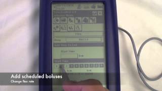 Buccal Midazolam Training Video [upl. by Sternlight]