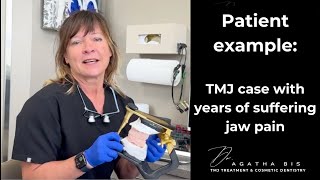 Patient example TMJ case with years of suffering jaw pain gone in minutes [upl. by Suirred]