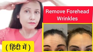 Forehead Massage  Remove Forehead Wrinkles Tension amp Stress  Natural Tips [upl. by Assetan]