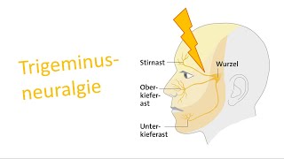 Trigeminusneuralgie [upl. by Edmead]