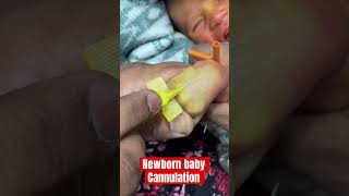 New born baby cannulation ivcannulation mbbs ivinsertion SMpharmacy subscribe [upl. by Ettennod]