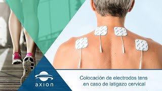 Colocación electrodos TENS para latigazo cervical  Electroestimulación TENS para terapia del dolor [upl. by Hcra]