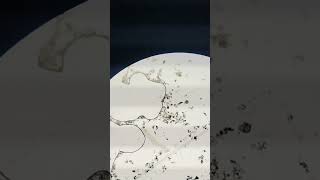 Zooplankton found in pond water biology microscopevideo [upl. by Eehsar718]