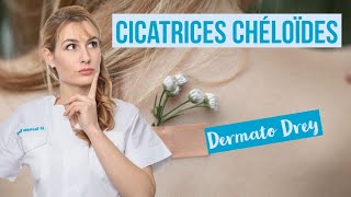 Les cicatrices chéloïdes comment les atténuer  DermatoDrey [upl. by Rossy278]