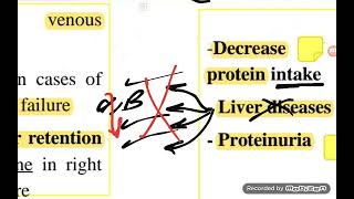 Hemodynamic 1  Pathology  Edema [upl. by Leanard]