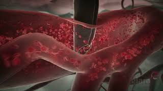 Malaria 3D Animation Shows How the Infection Spreads in the Body [upl. by Wrigley]