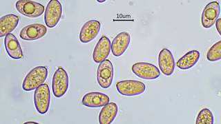 Diversità delle Spore di alcuni funghi [upl. by Ahsiei]