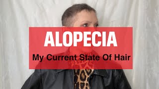 ALOPECIA My Current State Of Hair Or Lack Of [upl. by Adnowal]