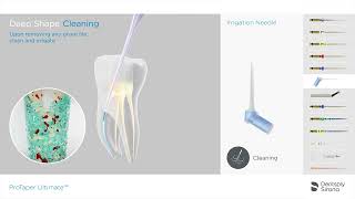 ProTaper Ultimate Endo File System  Full Slider  Shaper  Finisher Sequence [upl. by Ezarras]