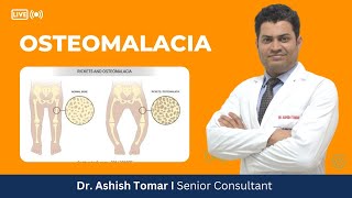 Everything about Osteomalacia I Dr Ashish Tomar [upl. by Anurb]