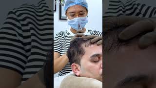 Cara Clinic Hair PRP Treatment Everything You Need to Know [upl. by Ailadi]