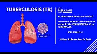 Tuberculose  Mythes brisés et faits surprenants [upl. by Frederigo]