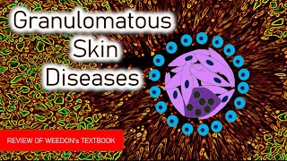 Dermatopathology Lesson 5 Granulomatous Skin Diseases Tissue Reaction Patterns [upl. by Halullat]