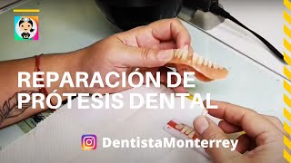 REPARACIÓN 👅Prótesis Dental [upl. by Horgan]