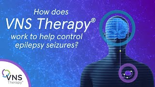 How does VNS Therapy Epilepsy Treatment Work [upl. by Rafaelita120]