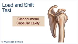 Load and Shift Test  Chiropractic Online CE™ [upl. by Dillie]