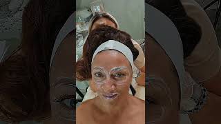 Malic Acid peel by Epionce in my always favourite DVmedSpa dermaquest epionce dermocosmetics [upl. by Fiske]