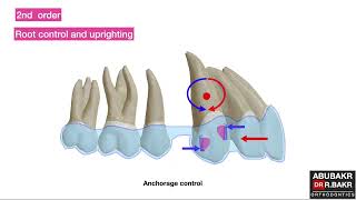 All you need to know about aligners amp attachments biomechanics part 2 [upl. by Hanikehs]