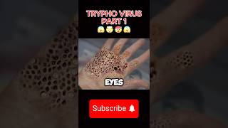 Trypo Virus Full movie Explained Part 1 movieexplain shorts [upl. by Levine]