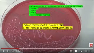 Lactose Fermenting and Nonlactose fermenting Colonies of Bacteria on Macconkey agar [upl. by Waite115]