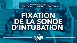 06  Fixation de la sonde dintubation [upl. by Inah998]