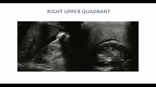 3 Basic Abdominal Ultrasound  PreExpedition Introduction to POCUS [upl. by Calva]