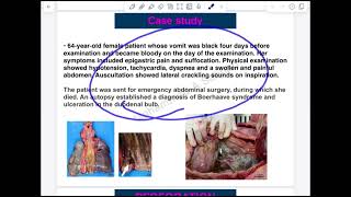 Esophagus Lec1  Second Part [upl. by Nanor]