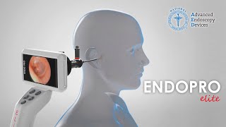 Introducing the MultiDisciplinary Use of the AED ENDOPROCAM® Elite [upl. by Niffirg640]